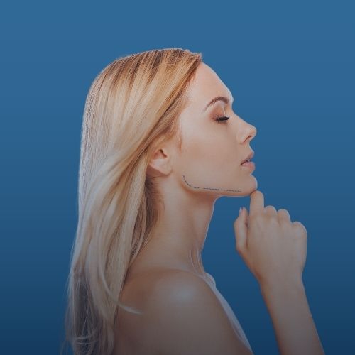 Jaw Line Çene Dolgusu